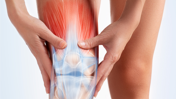 A graphic visualization of a human knee 