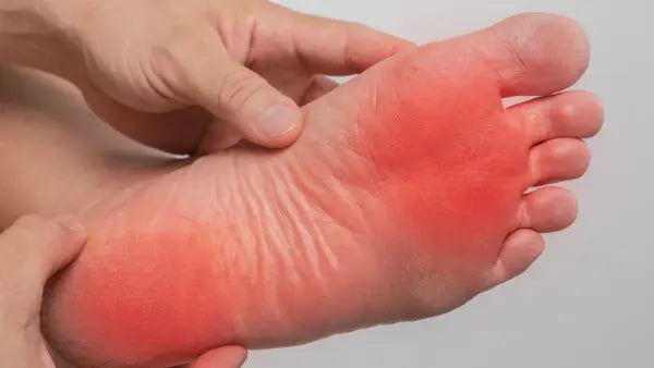 foot in pain