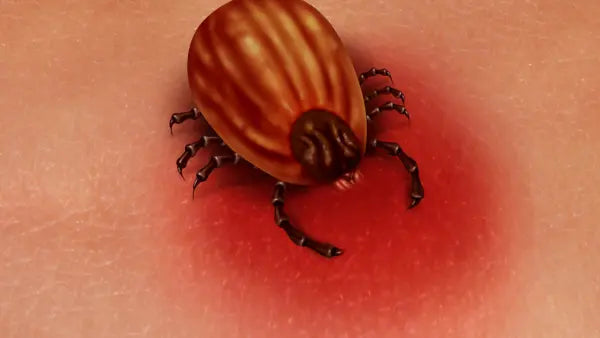 Red Light Therapy for Lyme Disease