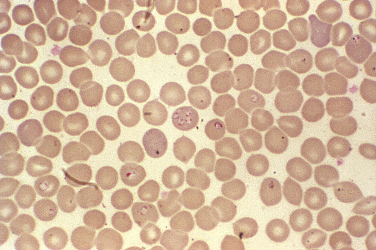 Why use EWOT for Babesia infections - One Thousand Roads