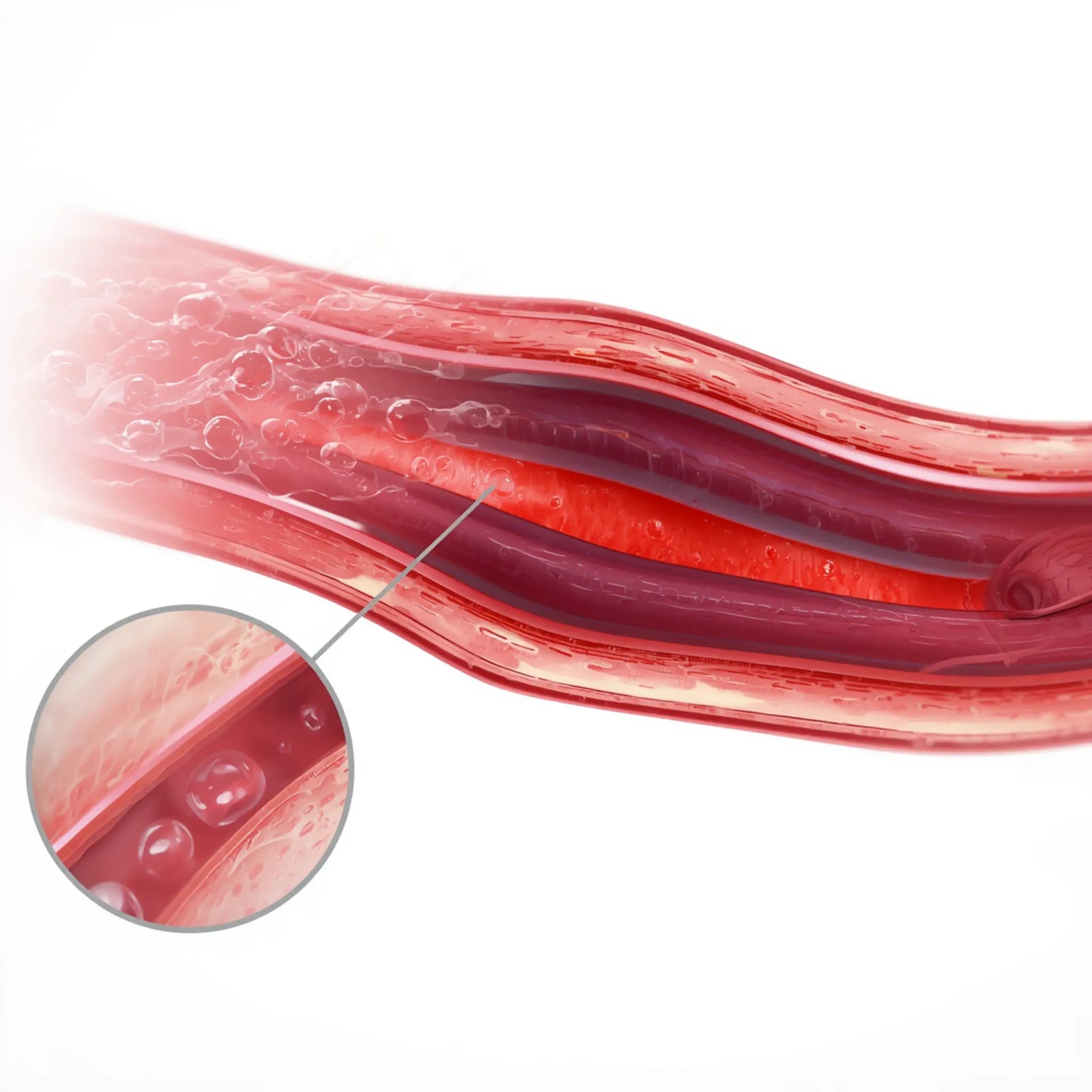 Dysfunctional Microcirculation